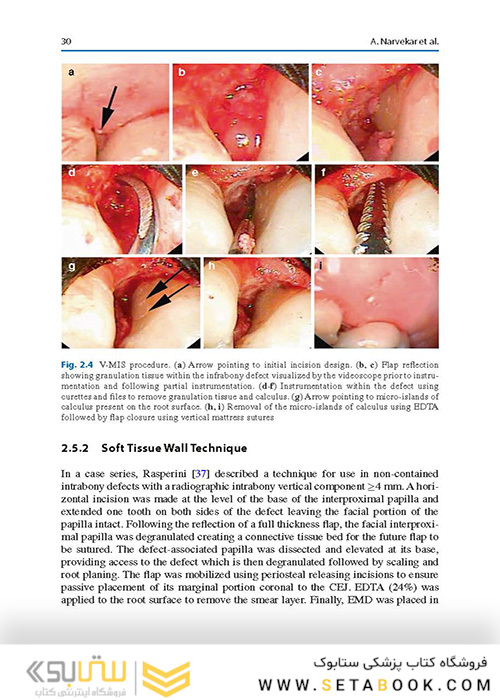  Advances in Periodontal Surgery: A Clinical Guide to Techniques and Interdisciplinary Approaches 1st ed. 2020 Edition پیشرفت در جراحی پریودنتال: راهنمای بالینی تکنیک ها و رویکردهای بین رشته ای