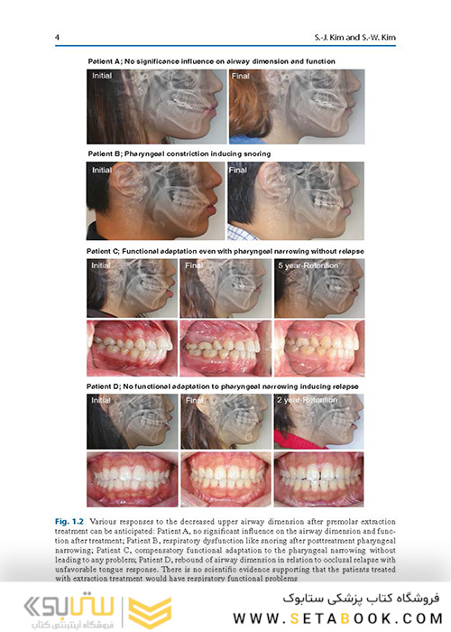 Orthodontics in Obstructive Sleep Apnea Patients: A Guide to Diagnosis, Treatment Planning, and Interventions 1st ed. 2020 Edition ارتودنسی در بیماران انسداد انسداد خواب: راهنمای تشخیص ، برنامه ریزی درمانی و مداخلات