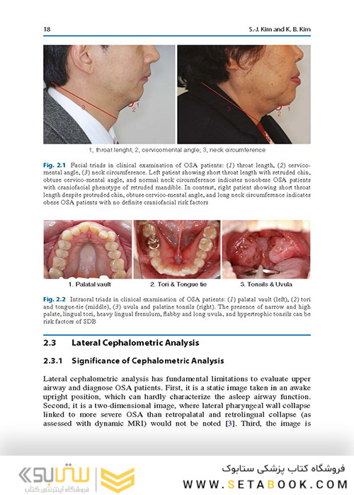  Orthodontics in Obstructive Sleep Apnea Patients: A Guide to Diagnosis, Treatment Planning, and Interventions 1st ed. 2020 Edition ارتودنسی در بیماران انسداد انسداد خواب: راهنمای تشخیص ، برنامه ریزی درمانی و مداخلات