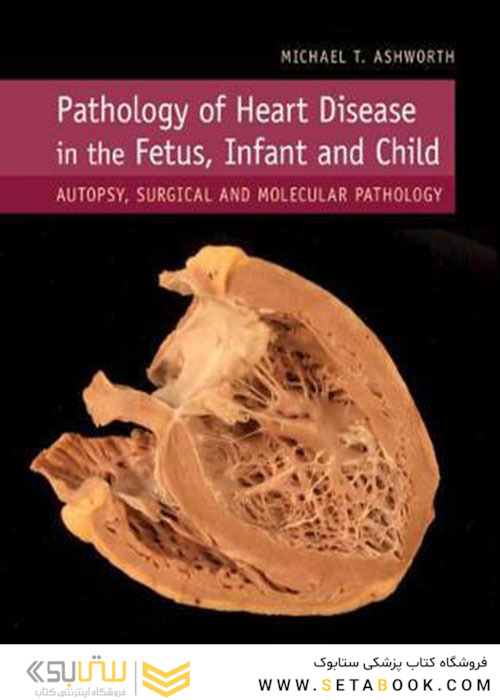 2019 Pathology of Heart Disease in the Fetus, Infant and Child: Autopsy, Surgical and Molecular Pathology 1st Edition  آسیب شناسی بیماری قلبی در جنین ، نوزاد و کودک
