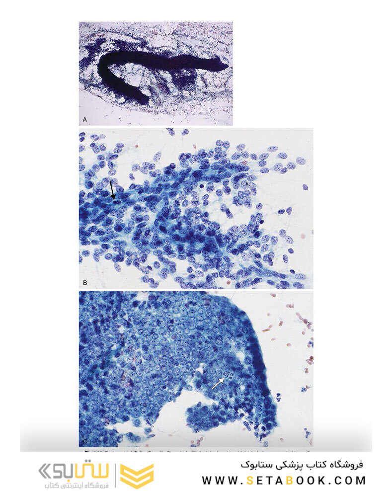 2021 Cytology: Diagnostic Principles and Clinical Correlates 5th Edition