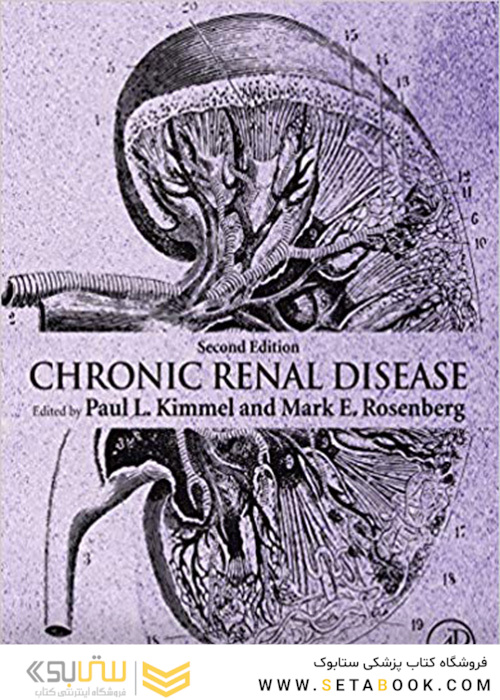  Chronic Renal Disease 2nd Edition, Kindle Edition 2020 بیماری مزمن کلیوی