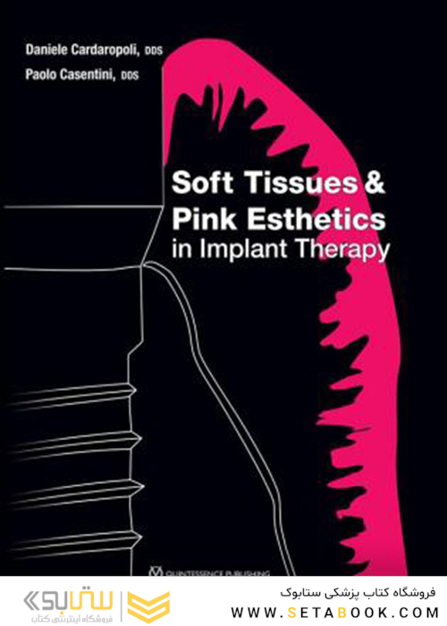 Soft Tissues and Pink Esthetics in Implant Therapy 1st Edition 2020 بافت نرم و زیبایی زیبایی صورتی در درمان ایمپلنت