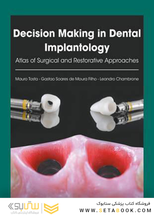 Decision Making in Dental Implantology: Atlas of Surgical and Restorative Approaches 1st Edition, Kindle Edition 2018 تصمیم گیری در ایمپلنتولوژی دندانپزشکی: اطلس رویکردهای جراحی و ترمیمی