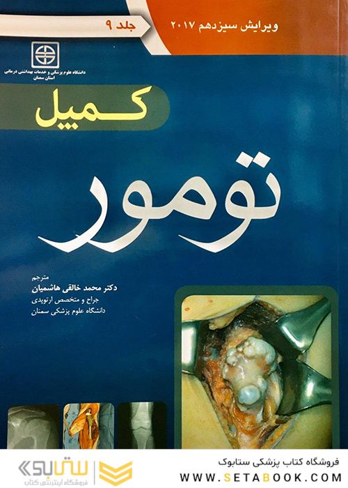 کمپل تومور 2017 جلد 9