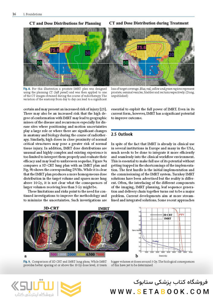 Image-Guided IMRT 1st Edition