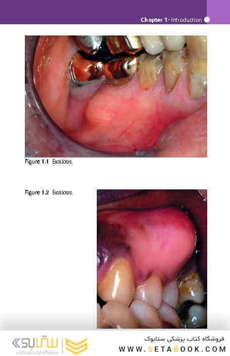 Pocketbook of Oral Disease 2012
