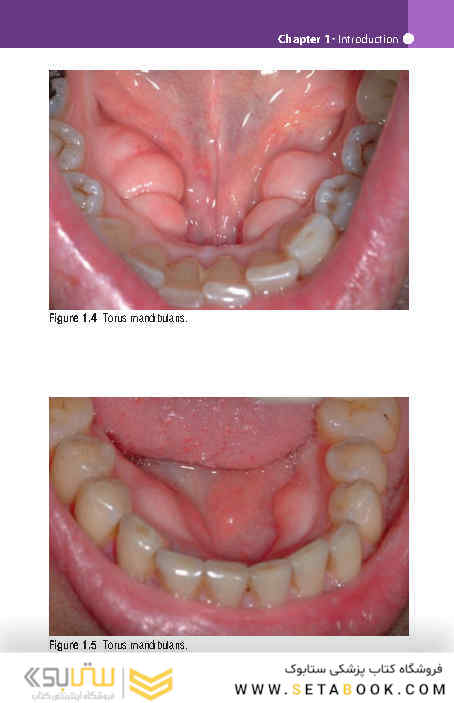 Pocketbook of Oral Disease 2012