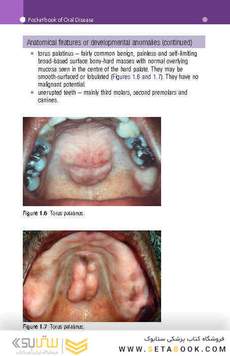 Pocketbook of Oral Disease 2012