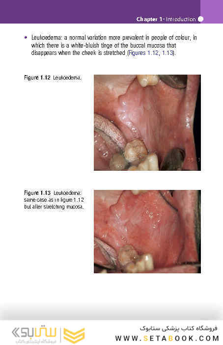 Pocketbook of Oral Disease 2012