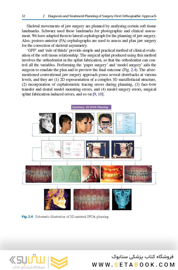 Surgery-First Orthodontic Management: A Clinical Guide to a New Treatment Approach 1st ed. 2019 Edition
