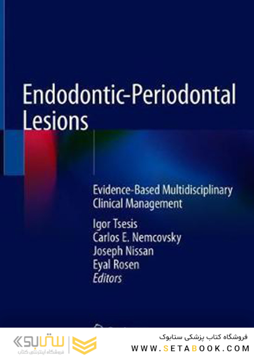 Endodontic-Periodontal Lesions: Evidence-Based Multidisciplinary Clinical Management 1st ed. 2019 Edition, Kindle Edition ضایعات اندودنتیک-پریودنتال