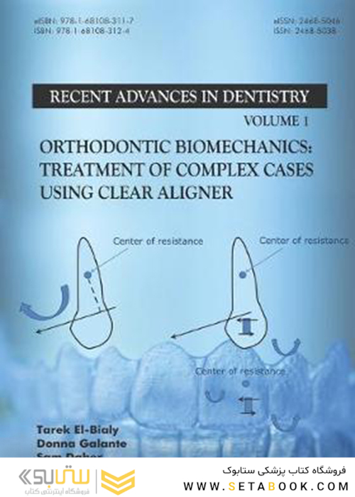 Orthodontic Biomechanics: Treatment Of Complex Cases Using Clear Aligner (Recent Advances in Dentistry