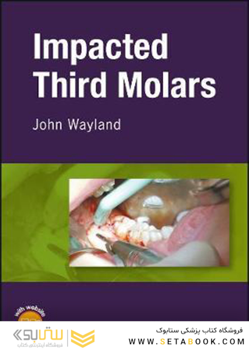 2018 Impacted Third Molars 1st Edition