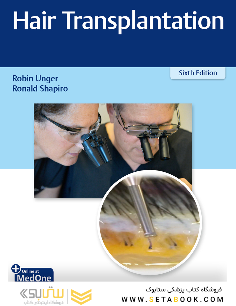 Hair Transplantation 2023