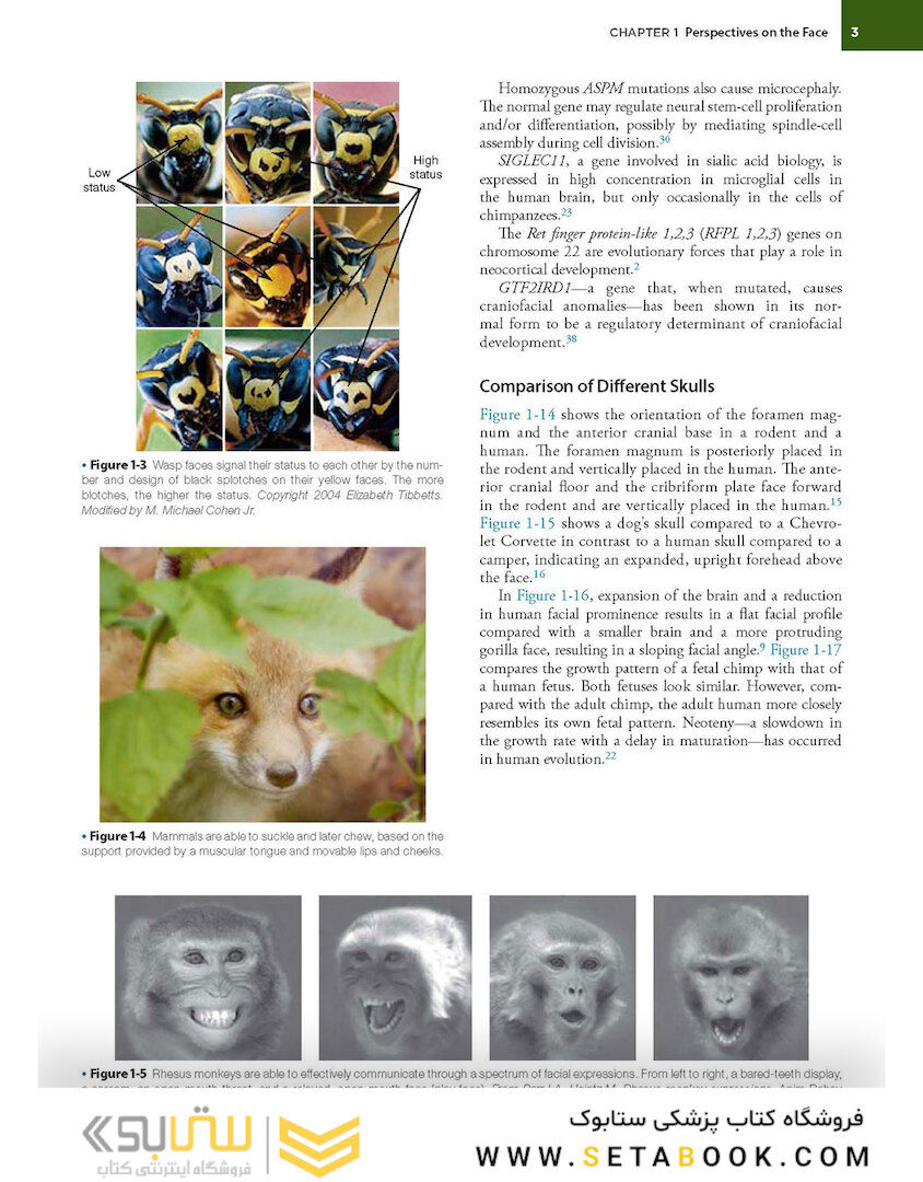 Orthognathic Surgery - 2 Volume Set: Principles and Practice 2nd Edition
