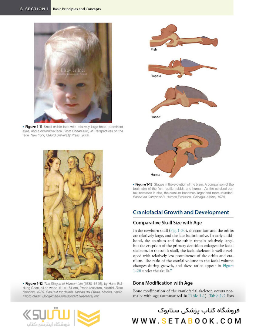 Orthognathic Surgery - 2 Volume Set: Principles and Practice 2nd Edition