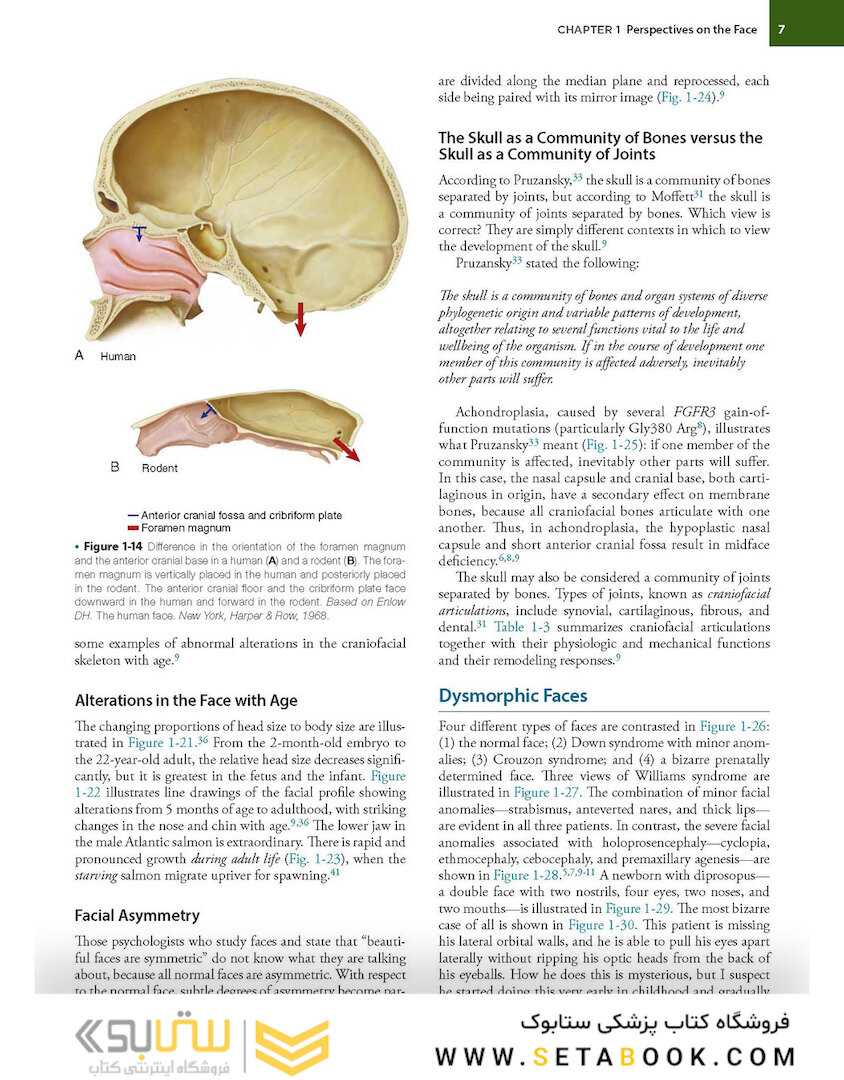 Orthognathic Surgery - 2 Volume Set: Principles and Practice 2nd Edition