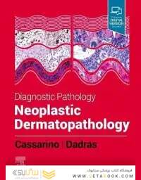 Diagnostic Pathology: Neoplastic Dermatopathology