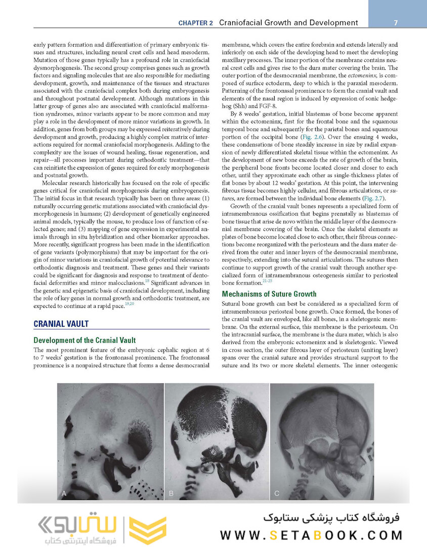 Orthodontics : Current Principles and Techniques
