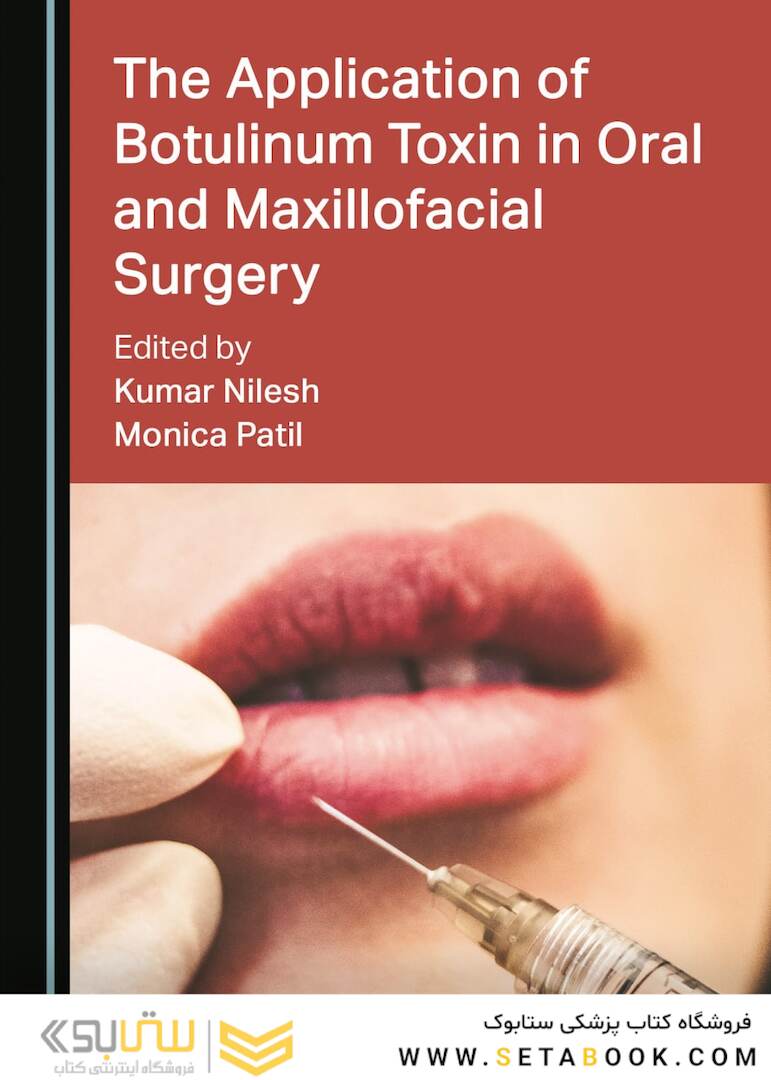 The Application of Botulinum Toxin in Oral and Maxillofacial Surgery