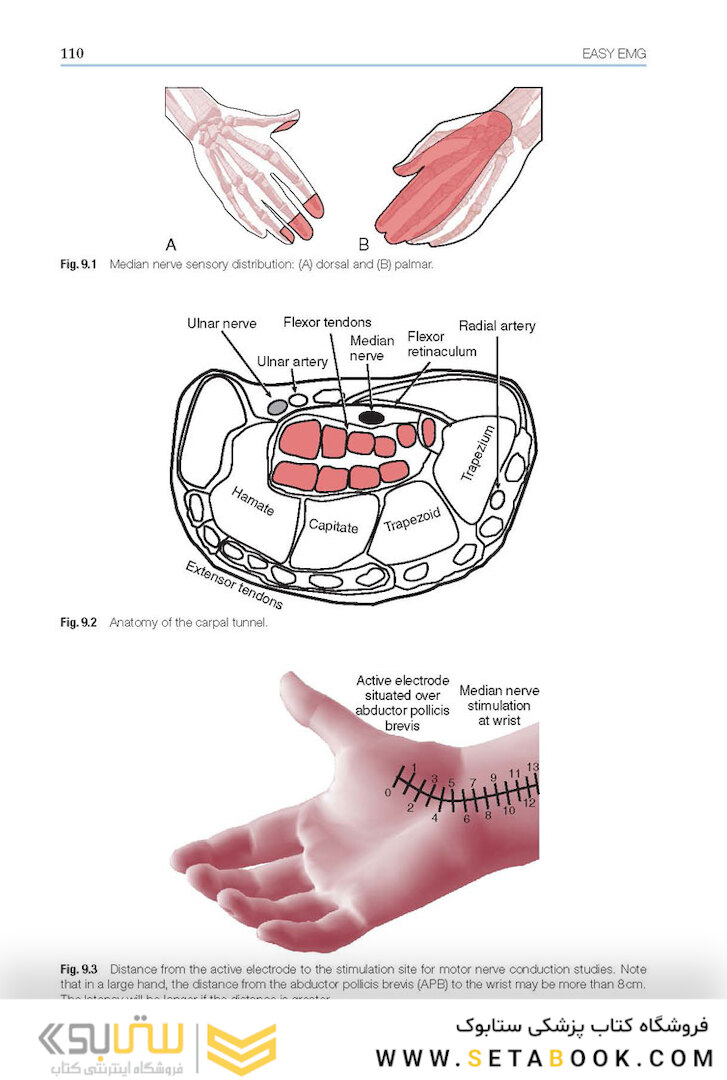 Easy EMG : A Guide to Performing Nerve Conduction Studies and Electromyography