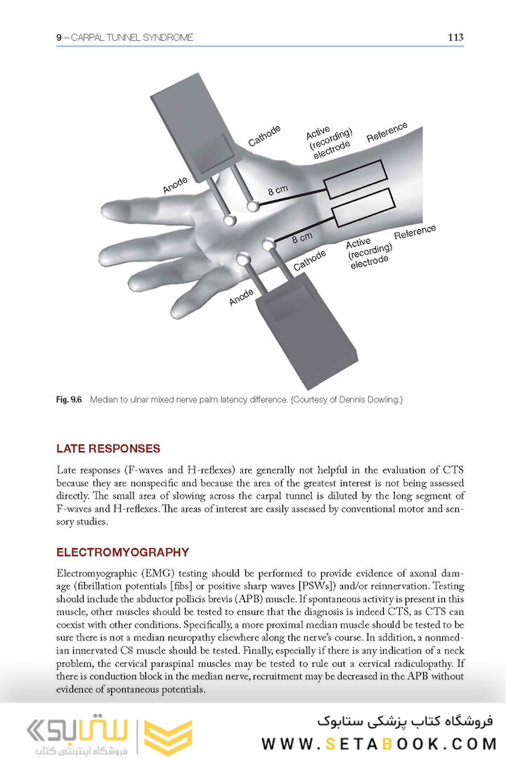Easy EMG : A Guide to Performing Nerve Conduction Studies and Electromyography