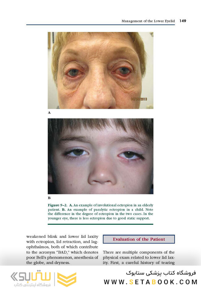 Facial Paralysis A Comprehensive Rehabilitative Approach