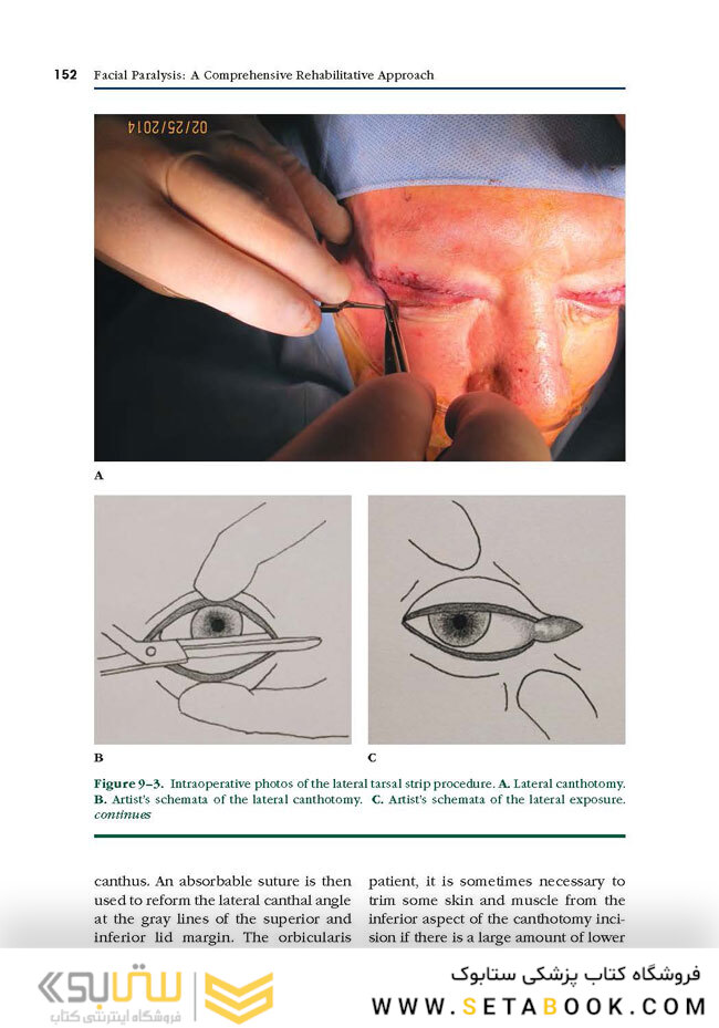 Facial Paralysis A Comprehensive Rehabilitative Approach