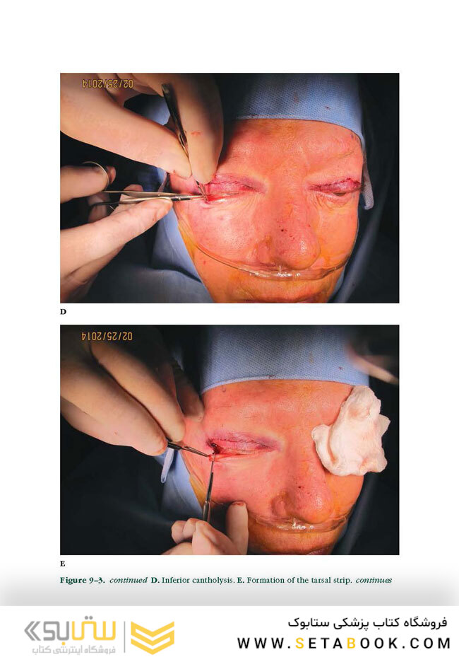 Facial Paralysis A Comprehensive Rehabilitative Approach