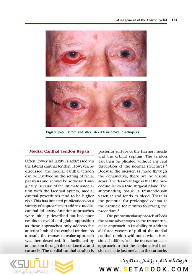 Facial Paralysis A Comprehensive Rehabilitative Approach