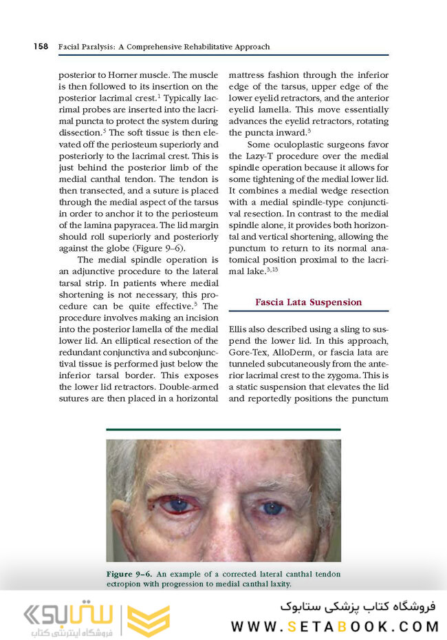 Facial Paralysis A Comprehensive Rehabilitative Approach