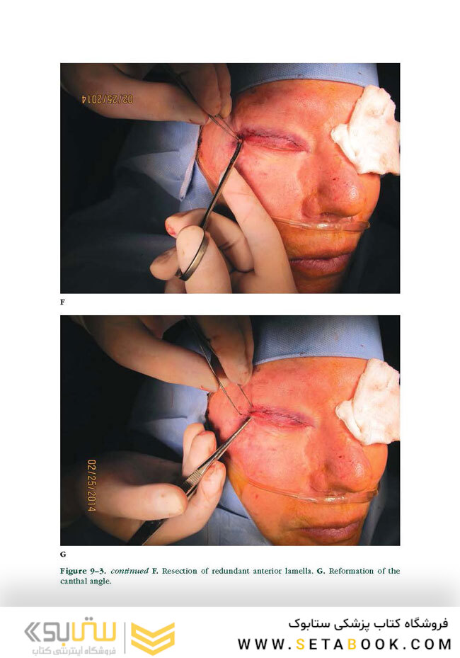 Facial Paralysis A Comprehensive Rehabilitative Approach