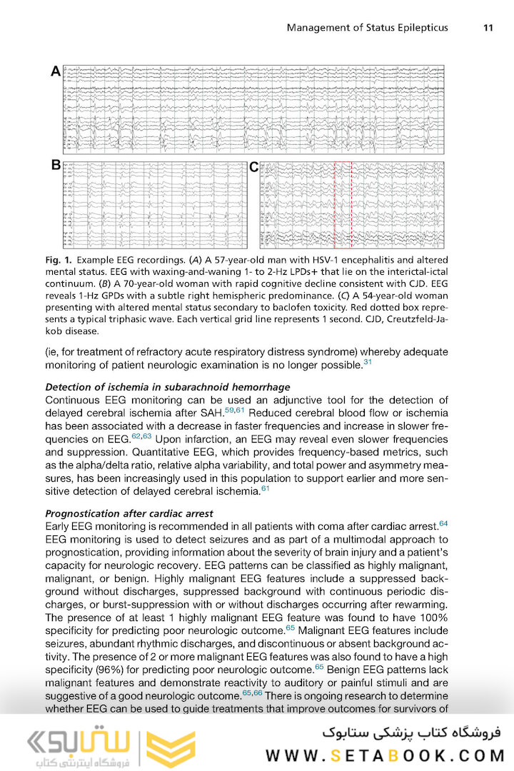 Neurologic Clinics: Hospital Neurology
