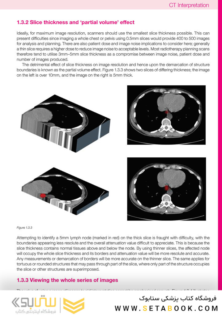 CT Anatomy for Radiotherapy2017