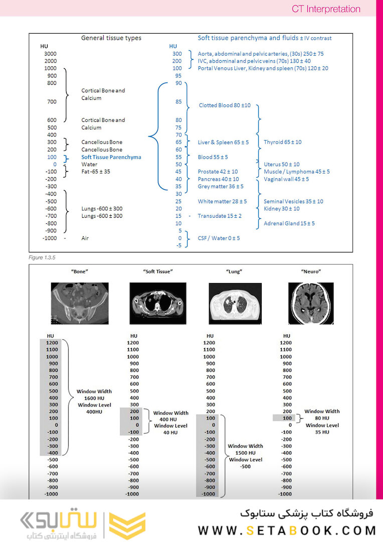 CT Anatomy for Radiotherapy2017
