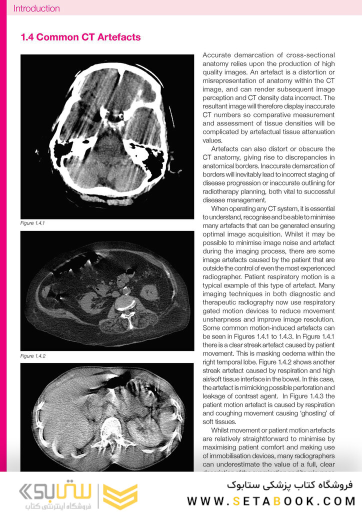 CT Anatomy for Radiotherapy2017