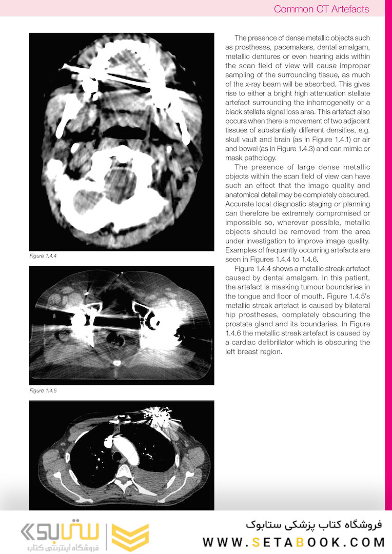 CT Anatomy for Radiotherapy2017