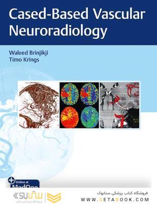 Imaging in Neurovascular Disease A Case-Based Approach