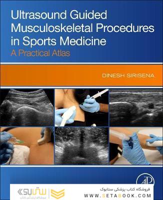 Ultrasound Guided Musculoskeletal Procedures in Sports Medicine : A Practical Atlas