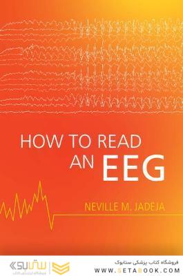 How to Read an EEG