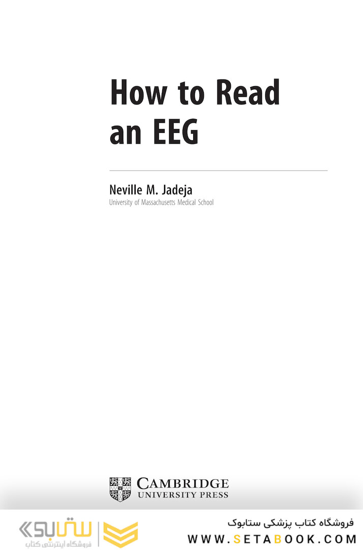 How to Read an EEG