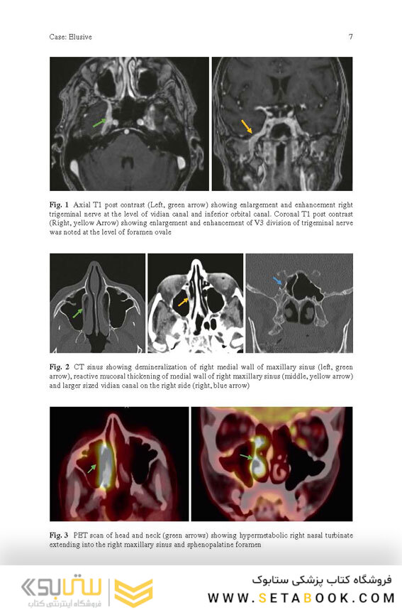 Challenging Cases in Neurologic Localization: An Evidence-Based Guide
