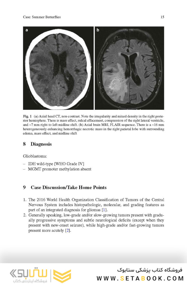Challenging Cases in Neurologic Localization: An Evidence-Based Guide