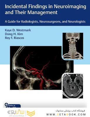Incidental Findings in Neuroimaging and Their Management: A Guide for Radiologists, Neurosurgeons, and Neurologists