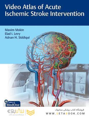 Video Atlas of Acute Ischemic Stroke Intervention