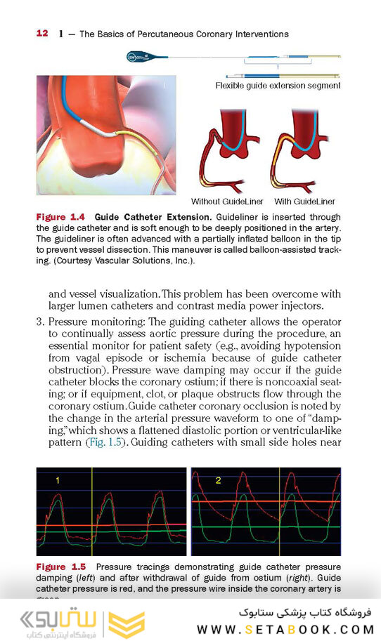 The Interventional Cardiac Catheterization Handbook