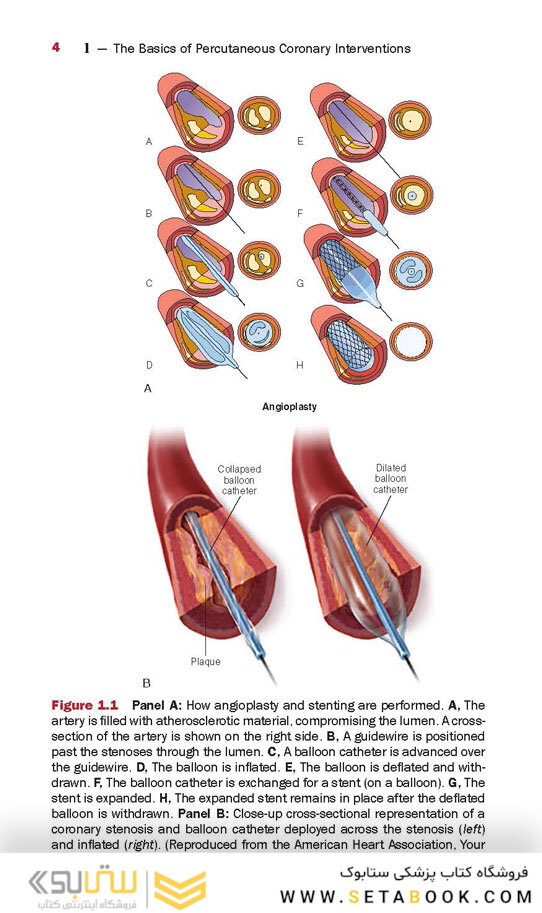 The Interventional Cardiac Catheterization Handbook