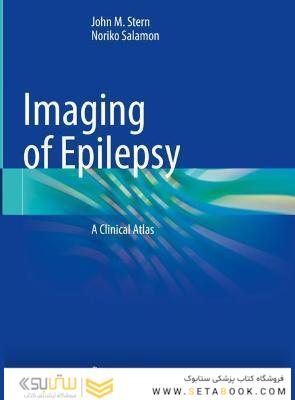 Imaging of Epilepsy: A Clinical Atlas