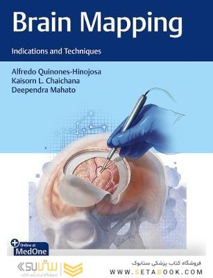 Brain Mapping Indications and Techniques